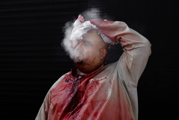 A Bahraini Shiite Muslim covered with blood smokes after flagellating himself with a sword as part of the Arbaeen ritual in Muharraq, Bahrain, Thursday, Dec. 3, 2015. (AP Photo/Hasan Jamali)